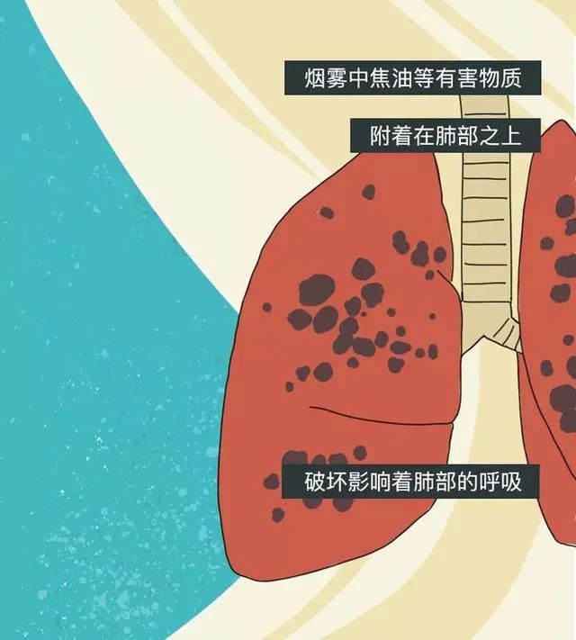 健康 | 你还记得第一次抽烟吗？深度解析，抽烟20年“人体变化”