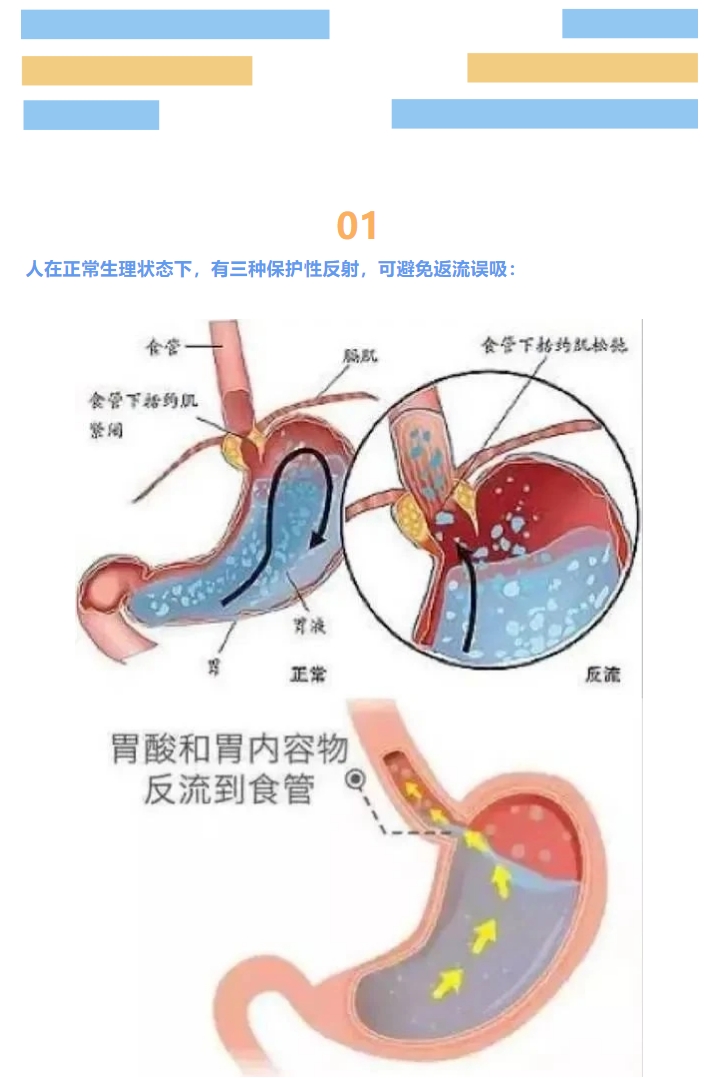 手术前后“饿肚子”，是为了保命！