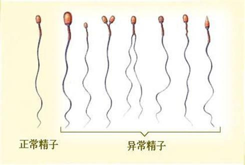 男性生殖健康科